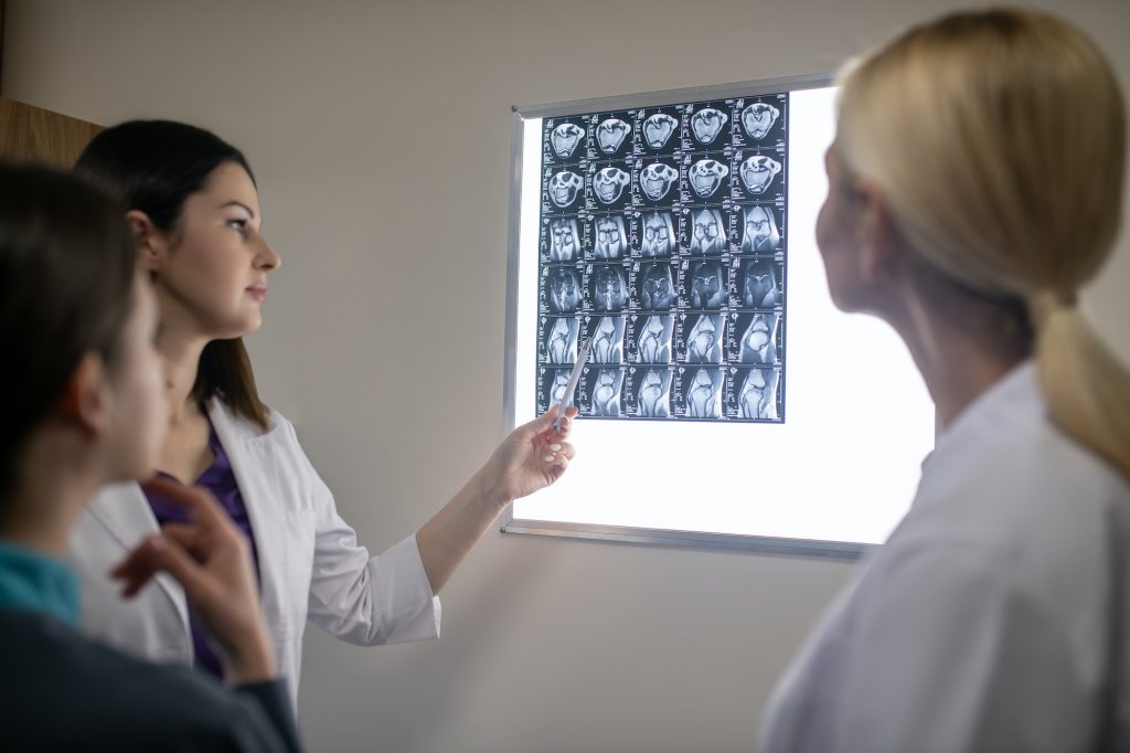 Doctors in neurological clinic discussing mri scan